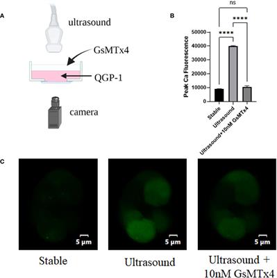 Examination of the mechanism of Piezo ion channel in 5-HT synthesis in the enterochromaffin cell and its association with gut motility